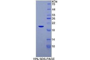 SDS-PAGE (SDS) image for CCAAT/enhancer Binding Protein (C/EBP), gamma (CEBPG) (AA 1-150) protein (His tag) (ABIN2124272)