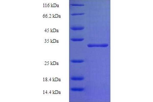 ATPC1 Protein (AA 23-168) (His-SUMO Tag)