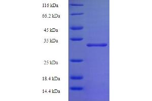 SDS-PAGE (SDS) image for ATP Synthase gamma Chain 1 (ATPC1) (AA 23-168) protein (His-SUMO Tag) (ABIN5709107)