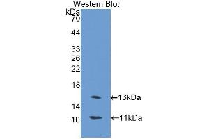 Western blot analysis of the recombinant protein. (SLC30A8 antibody  (AA 1-80))