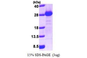GOPC Protein (AA 278-454) (His tag)