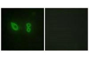 Immunofluorescence analysis of HeLa cells, using Actin α-2/3 antibody.