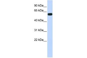 WB Suggested Anti-HIC2 Antibody Titration:  0. (HIC2 antibody  (Middle Region))