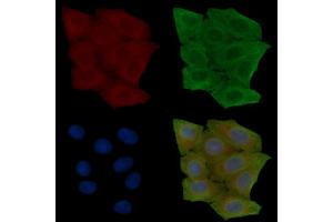 ABIN6257667 and ABIN6274155 staining Hela cells(30 min of UV treatment) by IF/ICC.