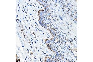 Immunohistochemistry of paraffin-embedded human esophageal using OGDHL Rabbit pAb (ABIN7269135) at dilution of 1:200 (40x lens). (OGDHL antibody  (AA 1-110))