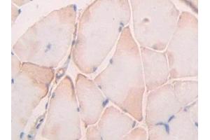 Detection of UBD in Rat Skeletal muscle Tissue using Polyclonal Antibody to Ubiquitin D (UBD) (UBD antibody  (AA 1-155))