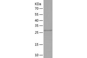 Western Blotting (WB) image for Zinc Finger CCCH-Type Containing 12A (ZC3H12A) (AA 234-503) protein (His tag) (ABIN7125769) (ZC3H12A Protein (AA 234-503) (His tag))