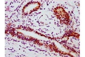 Immunohistochemistry (IHC) image for anti-Signal Transducer and Activator of Transcription 1, 91kDa (STAT1) (pSer727) antibody (ABIN7127753)
