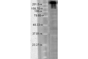 Western Blot analysis of hamster CHO cells showing detection of Nav1. (SCN9A antibody  (AA 1751-1946) (APC))