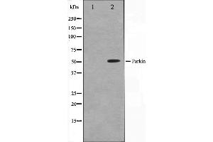 Western blot analysis on HeLa cell lysate using Parkin Antibody. (Parkin antibody  (Internal Region))