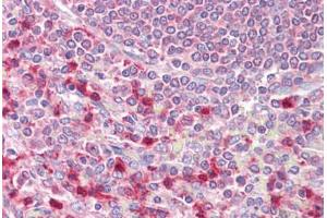Anti-EIF4B antibody IHC staining of human spleen. (EIF4B antibody  (AA 570-630))