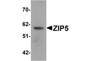 Western blot analysis of ZIP5 in human spleen tissue lysate with ZIP5 antibody at 1 μg/ml. (SLC39A5 antibody  (Center))