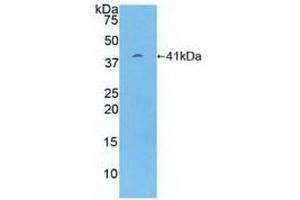Detection of Recombinant PSMD7, Human using Polyclonal Antibody to Proteasome 26S Subunit, Non ATPase 7 (PSMD7)