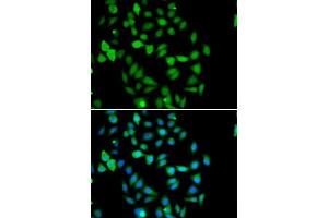 Immunofluorescence analysis of U2OS cells using STAMBP antibody. (STAMBP antibody  (AA 100-270))