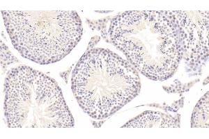 Detection of tPA in Mouse Testis Tissue using Polyclonal Antibody to Tissue Plasminogen Activator (tPA) (PLAT antibody  (AA 359-532))