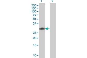 Western Blot analysis of CCDC88B expression in transfected 293T cell line by CCDC88B MaxPab polyclonal antibody. (CCDC88B antibody  (AA 1-223))