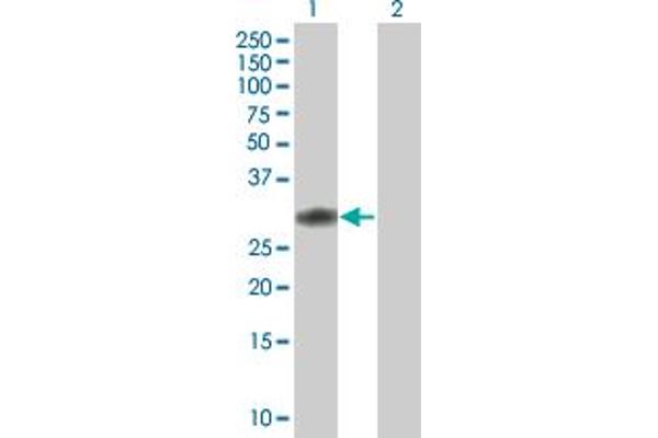 CCDC88B antibody  (AA 1-223)