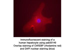 Image no. 1 for anti-MLX Interacting Protein-Like (MLXIPL) (AA 800-852), (C-Term), (Isoform 1) antibody (ABIN363458) (MLXIPL antibody  (C-Term, Isoform 1))