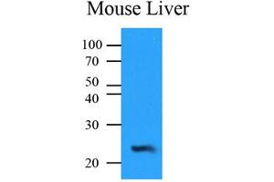 Western Blotting (WB) image for anti-NQO2 (NQO2) antibody (ABIN567621) (NQO2 antibody)