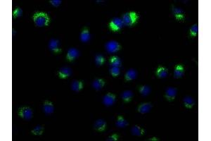 Immunofluorescence (IF) image for anti-CD63 (CD63) (AA 103-203) antibody (ABIN7147175)