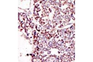 Image no. 2 for anti-TYRO3 Protein Tyrosine Kinase (TYRO3) (C-Term) antibody (ABIN359940) (TYRO3 antibody  (C-Term))