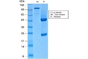 SDS-PAGE Analysis of Purified CK HMW Rabbit Recombinant Monoclonal Antibody (KRTH/2147R). (Recombinant Cytokeratin 2 antibody)