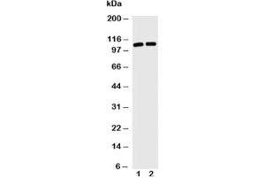 Western blot with TRIF antibody and Lane 1: Jurkat;  2: HL-60 cell lysate (TICAM1 antibody  (C-Term))