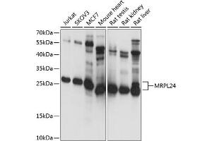 Western blot analysis of extracts of various cell lines, using MRPL24 antibody (ABIN7268565) at 1:1000 dilution. (MRPL24 antibody  (AA 1-216))