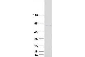 Validation with Western Blot (RORC Protein (Transcript Variant 1) (Myc-DYKDDDDK Tag))