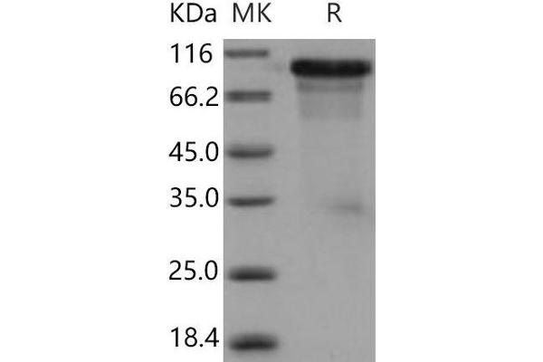 ECM1 Protein (His tag)