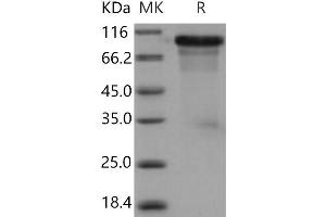 Western Blotting (WB) image for Extracellular Matrix Protein 1 (ECM1) (Active) protein (His tag) (ABIN7320312)