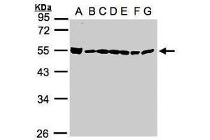 WB Image Sample(30μg whole cell lysate) A: 293T B: A431 , C: H1299 D: HeLa S3 , E: Hep G2 , F: MOLT4 , G: Raji , 10% SDS PAGE antibody diluted at 1:1000 (BAT1 antibody  (Center))