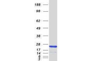 Validation with Western Blot (PTP4A2 Protein (Transcript Variant 1) (Myc-DYKDDDDK Tag))