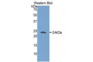 Western Blotting (WB) image for anti-Glutathione Synthetase (GSS) (AA 270-474) antibody (ABIN1859085) (Glutathione Synthetase antibody  (AA 270-474))