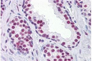 Human Prostate: Formalin-Fixed, Paraffin-Embedded (FFPE) (RUNX2 antibody  (AA 251-351))
