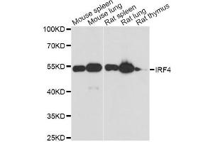 Western blot analysis of extracts of various cell lines, using IRF4 antibody. (IRF4 antibody)