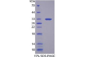 Image no. 1 for NADPH Oxidase 1 (NOX1) (AA 291-544) protein (His tag) (ABIN4988461) (NOX1 Protein (AA 291-544) (His tag))