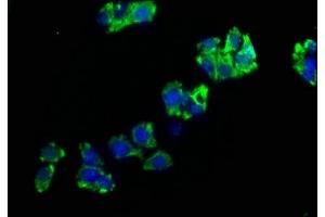 Immunofluorescence staining of HepG2 cells with ABIN7151394 at 1:200, counter-stained with DAPI. (ENPP7 antibody  (AA 22-216))