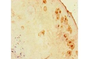 Immunohistochemistry of paraffin-embedded human placenta tissue using ABIN7176259 at dilution of 1:100