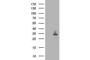 HEK293T cells were transfected with the pCMV6-ENTRY control (Left lane) or pCMV6-ENTRY PNPO (Right lane) cDNA for 48 hrs and lysed. (PNPO antibody)