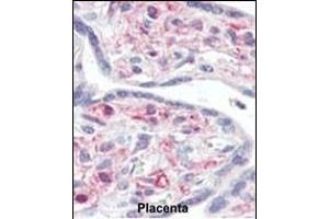 Formalin-fixed and paraffin-embedded human Placenta tissue reacted with IRAK Antibody (C-term) (ABIN392233 and ABIN2841927) , which was peroxidase-conjugated to the secondary antibody, followed by AEC staining.