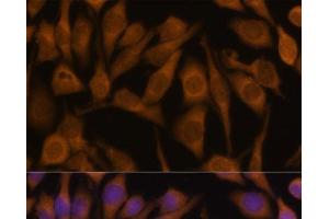 Immunofluorescence analysis of HeLa cells using UBQLN2 Polyclonal Antibody at dilution of 1:100 (40x lens). (Ubiquilin 2 antibody)