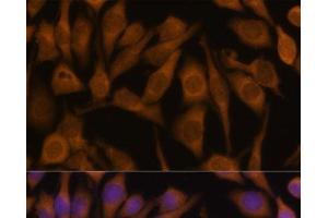 Immunofluorescence analysis of HeLa cells using UBQLN2 Polyclonal Antibody at dilution of 1:100 (40x lens).