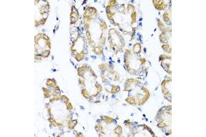 Immunohistochemistry of paraffin-embedded human stomach using ST6G antibody (ABIN6130083, ABIN6148536, ABIN6148538 and ABIN6221427) at dilution of 1:100 (40x lens). (ST6GAL1 antibody  (AA 27-200))