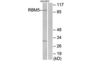 Western blot analysis of extracts from HuvEc cells, using RBM5 Antibody. (RBM5 antibody  (AA 226-275))