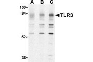 Western blot analysis of TLR3 in K562 cell lysate with this product at (A) 0. (TLR3 antibody  (N-Term))