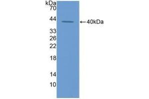 Detection of Recombinant ECF, Rat using Polyclonal Antibody to Eosinophil Chemotactic Factor (ECF) (ECF antibody  (AA 24-97))