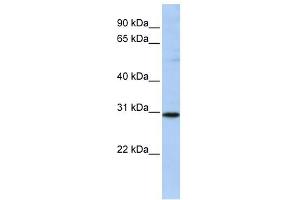 RAB26 antibody used at 1 ug/ml to detect target protein.