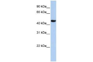 WB Suggested Anti-ZNF286A Antibody Titration:  0. (ZNF286A antibody  (N-Term))