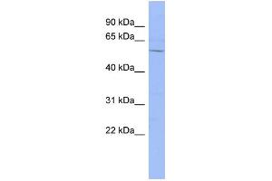 WB Suggested Anti-DACH1 Antibody Titration:  0. (DACH1 antibody  (N-Term))